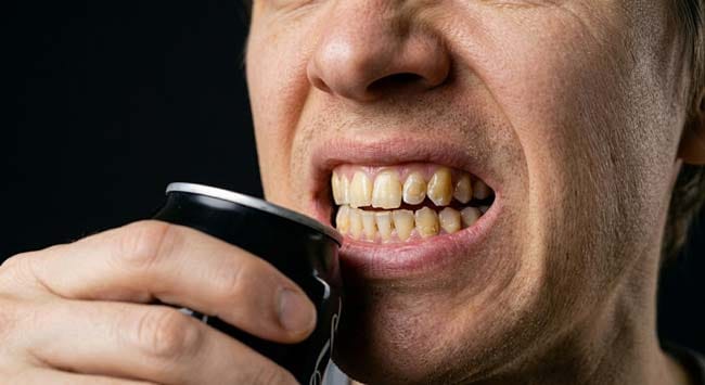 Close-up of teeth showing enamel erosion damage next to a cola can illustrating how phosphoric acid in cola dissolves tooth enamel and depletes bone calcium through PTH activation