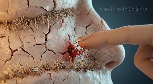 A 3D close-up view inside a human nasal cavity showing dry, cracked mucosa, brittle matted cilia, and a finger causing a micro-tear and a red particle fountain of blood