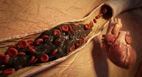 3D micro-sculpt showing blood cells thickening into a dark sludge-like texture due to extreme water loss