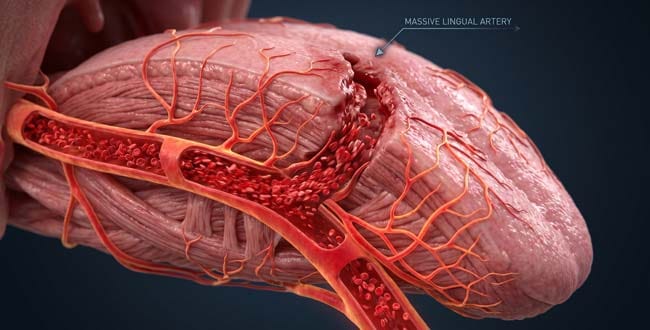 3D medical visualization of lingual artery blood supply surging toward a tongue wound showing why the tongue heals faster than skin tissue