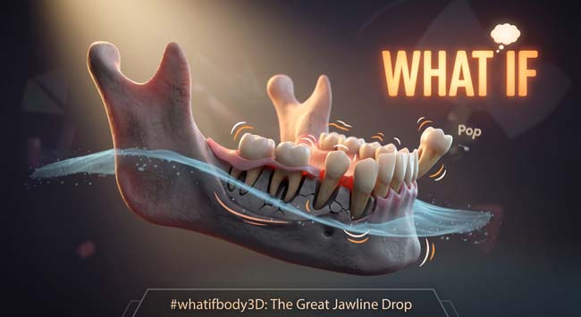 Dramatic 3D animation showing jawbone level dropping and teeth becoming loose in whatifbody3D fun 'What If' tooth scenario visualization