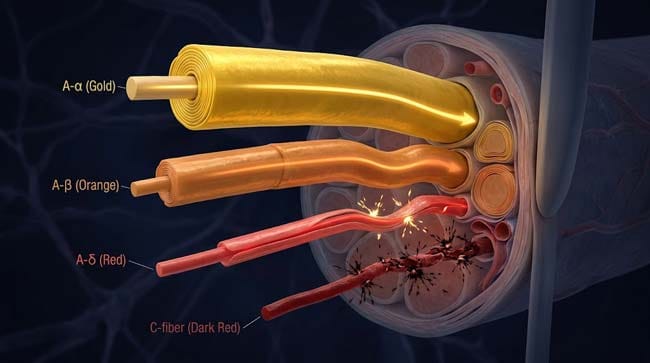 3D cross-section showing four peripheral nerve fiber types A-alpha A-beta A-delta and C fibers with different compression sensitivity showing why different sensations fade and return at different rates when a leg falls asleep